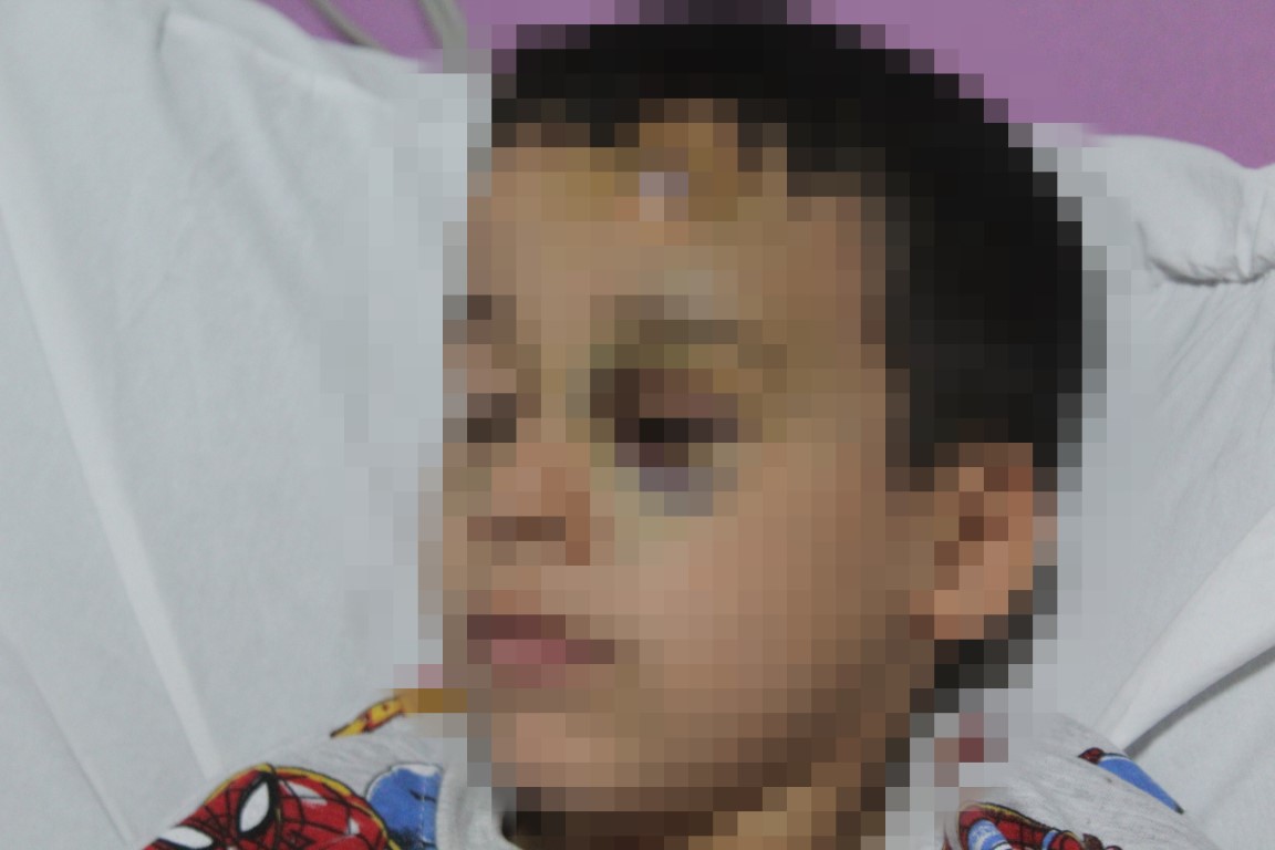 Çocuk hizmetleri yurdunda kalan 8 yaşındaki çocuğa darp iddiası
