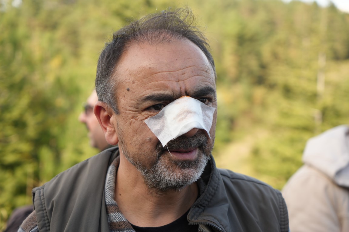 TEM’de yolcu otobüsü tıra çarptı: 13 yaralı