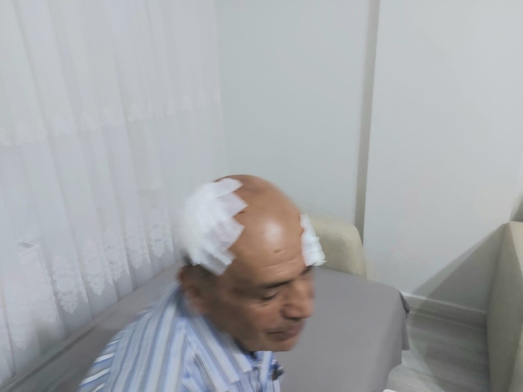 Şanlıurfa’da kamyonun çarptığı tabelanın altında kalan adam ölümden döndü