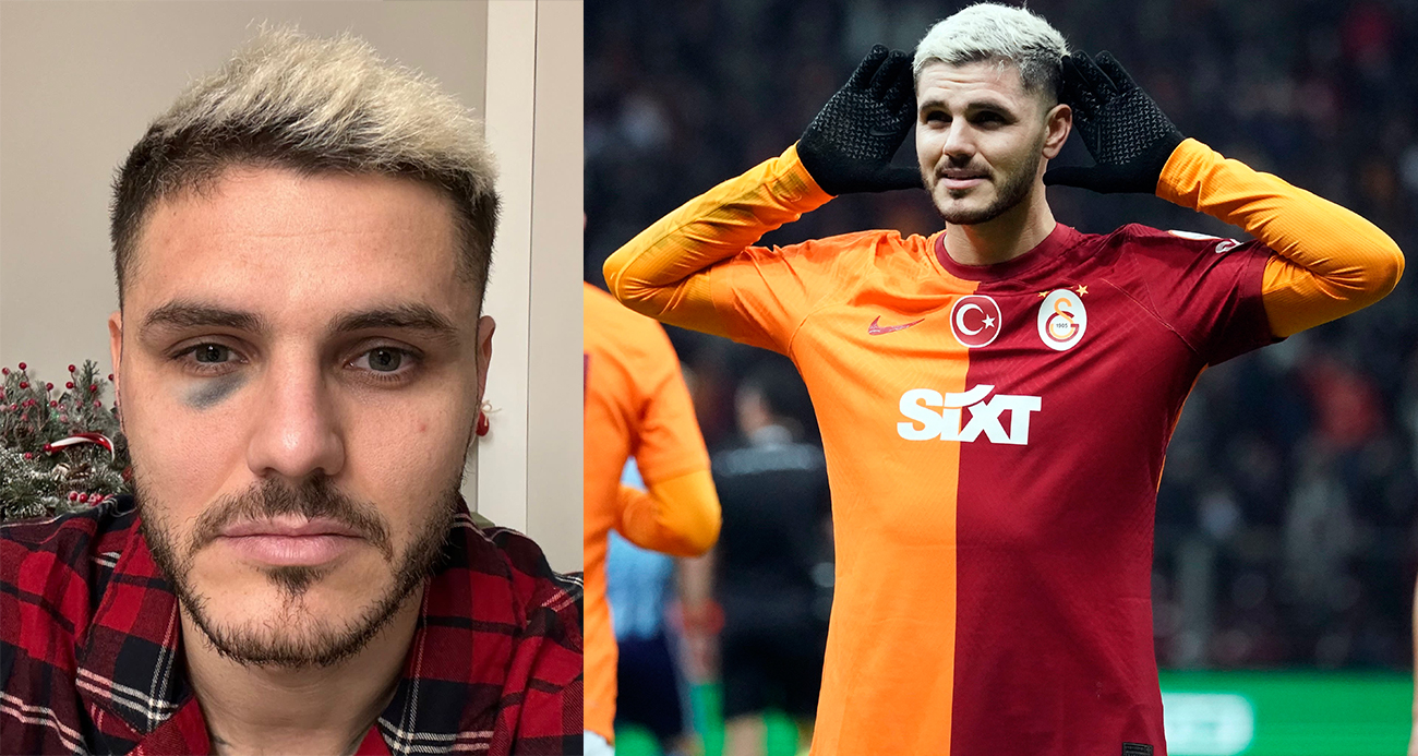 Galatasaray'dan Mauro Icardi açıklaması