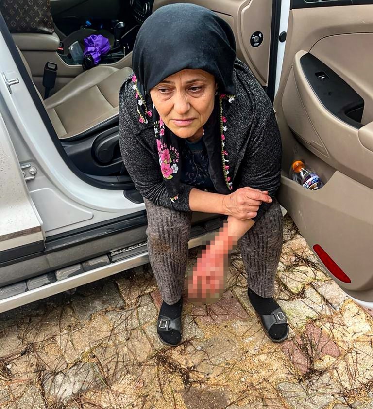 Yumurta toplamak için bahçeye giren kadın, dobermanın saldırısına uğradı