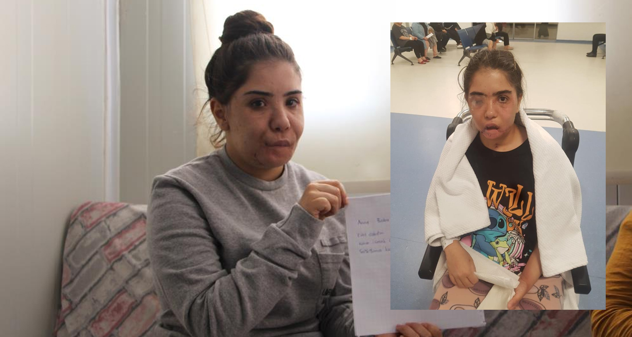 Depremde çenesini kaybetmişti! Genç kızın tek hayali tekrar konuşabilmek