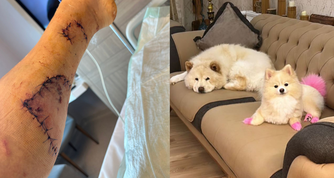 Köpek evdeki diğer köpeği kıskandı, ev sahibi hastanelik oldu