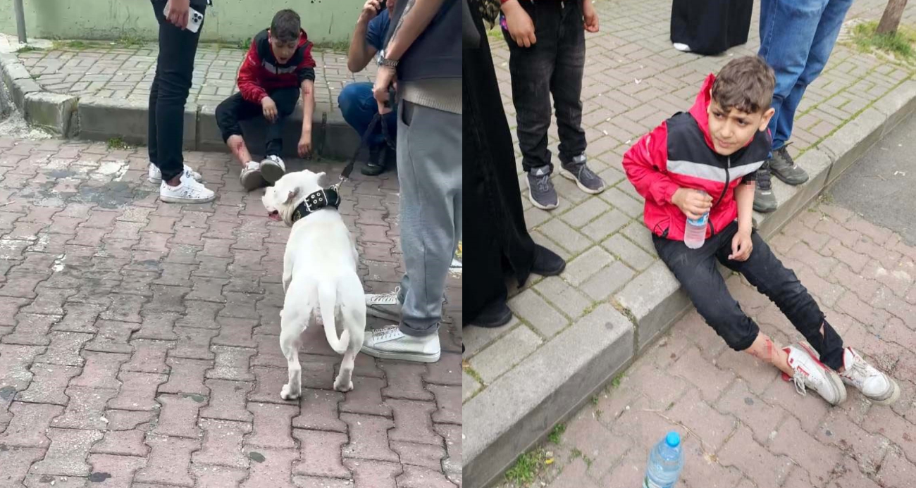 Kağıthane’de mezarlıkta başıboş bir köpek 12 yaşındaki çocuğu ısırdı
