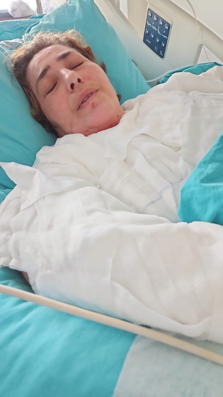 Düdüklü tencere bomba gibi patladı, dehşeti yaşayan kadın: “Kapak yüzüme gelse kurtuluşum olmazdı”