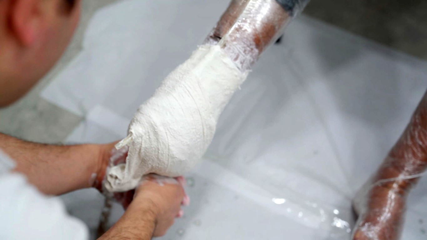 Asrın felaketinde 261 saat enkaz altında kalan Mustafa Avcı protezine kavuştu