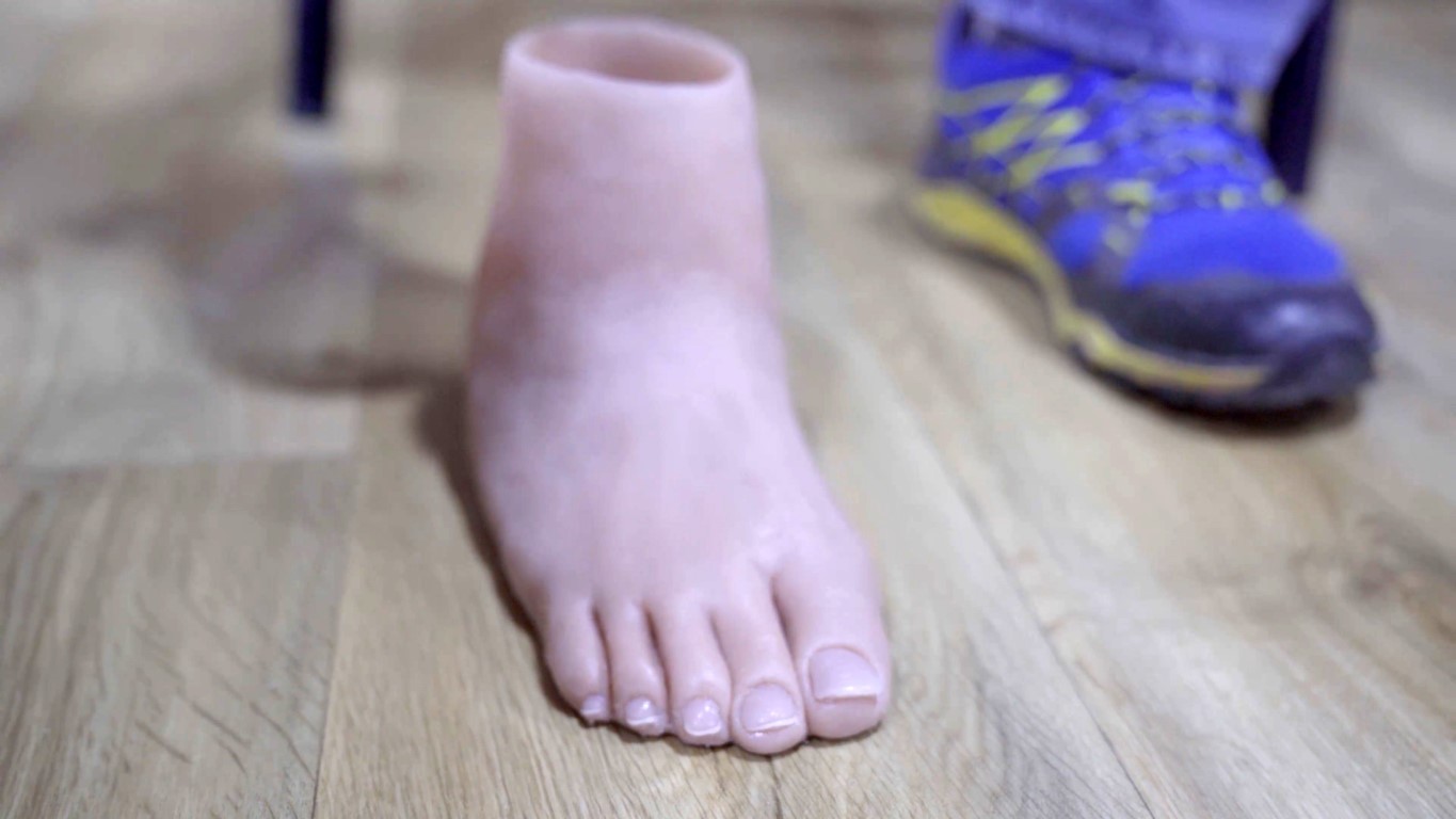 Asrın felaketinde 261 saat enkaz altında kalan Mustafa Avcı protezine kavuştu