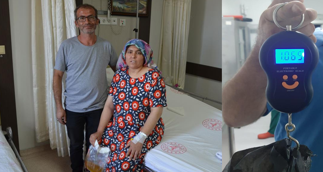 Ağrı şikayetiyle gitti, mesanesinden 1 kilogramlık taş çıkarıldı