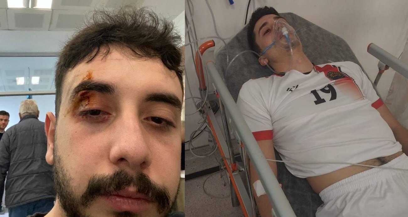 Voleybolculara taraftarlar saldırdı: 3 sporcu yaralandı