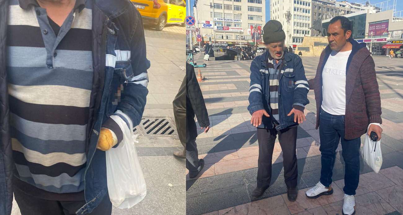 Gaziantep’te 'pes' dedirten dilenci