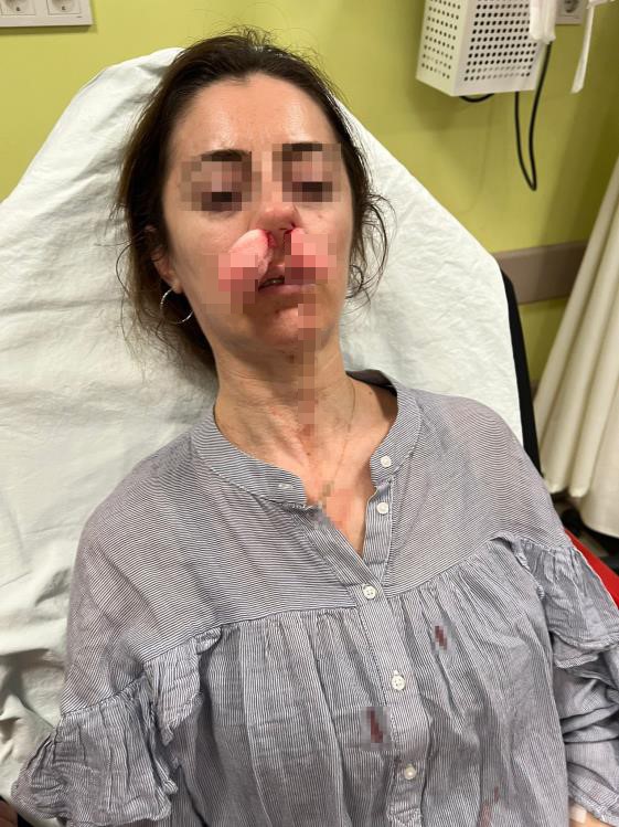 Kocasının sevgilisine benzetildiği için yanlışlıkla darp edilen kadın o anları anlattı