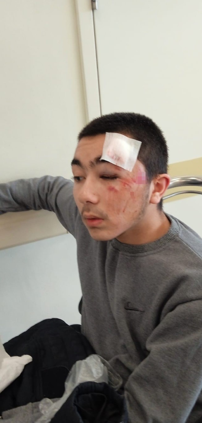 Başıboş köpeklerden kaçarken düşen 16 yaşındaki hafız ölümden döndü