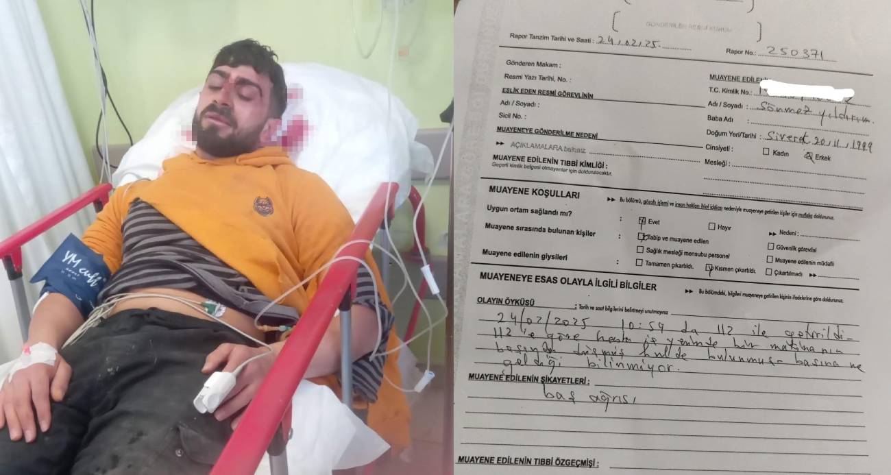 Kafasına yaklaşık 35 dikiş atıldı: Hastanede 