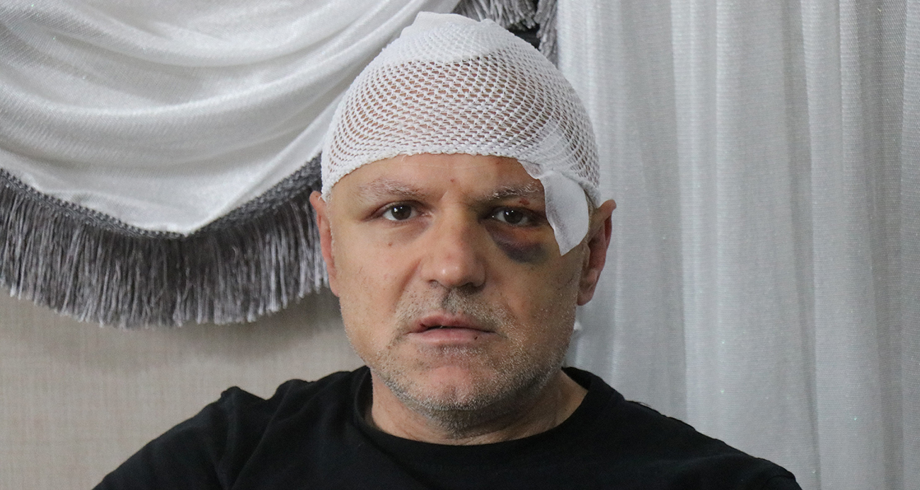 Öldüresiye darp edilen tekel bayii işletmecisi yaşadığı dehşeti anlattı