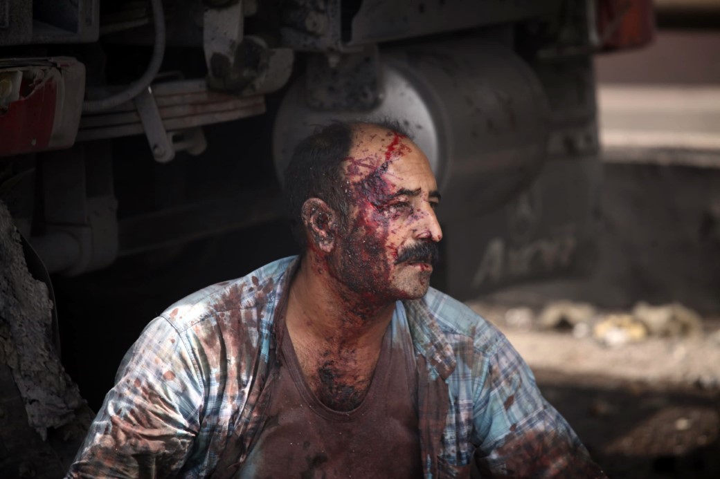 İran’da limanda şiddetli patlama: Çok sayıda yaralı var!