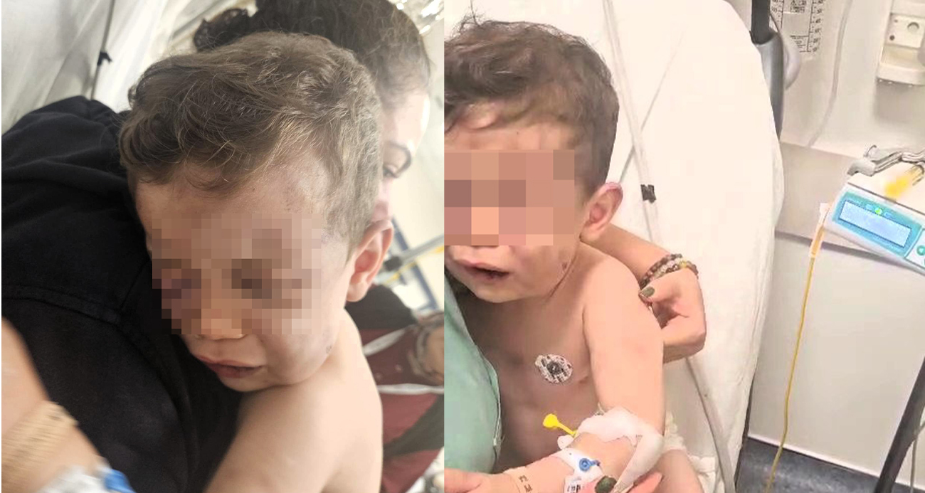 Vahşeti yaşayan 2 yaşındaki bebek hastanelik oldu