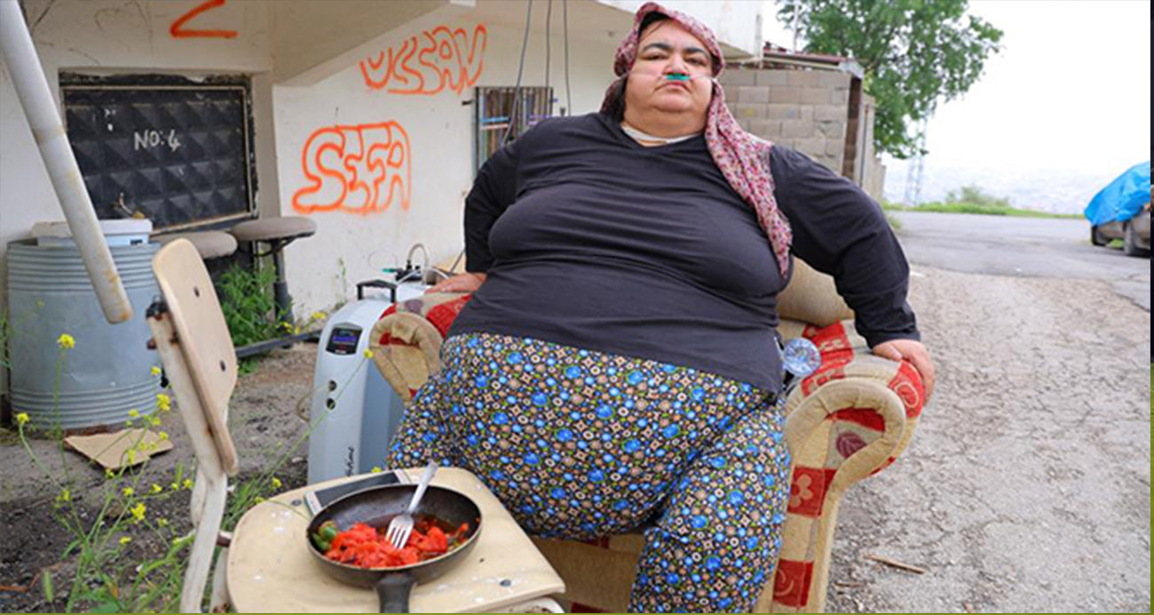 Bir çocuk annesinin zorlu yaşam mücadelesi: Kilosu 200’e dayandı