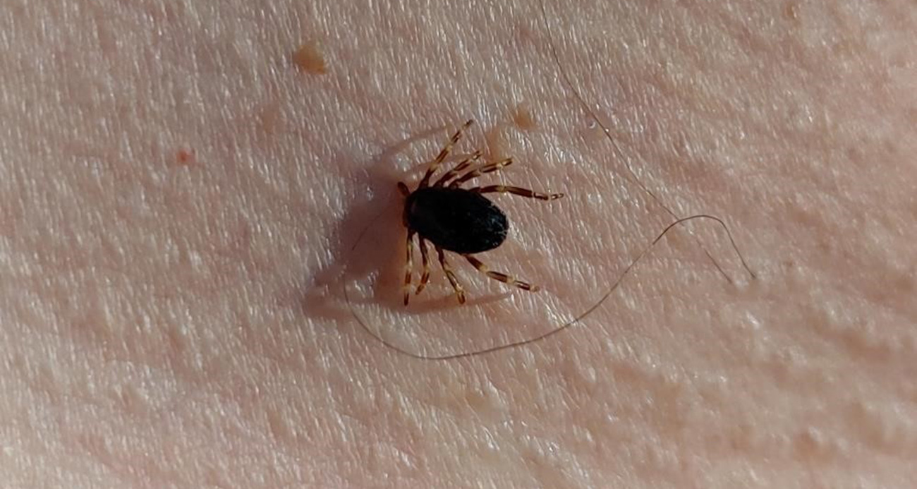 Havalar ısındı, kene kabusu başladı