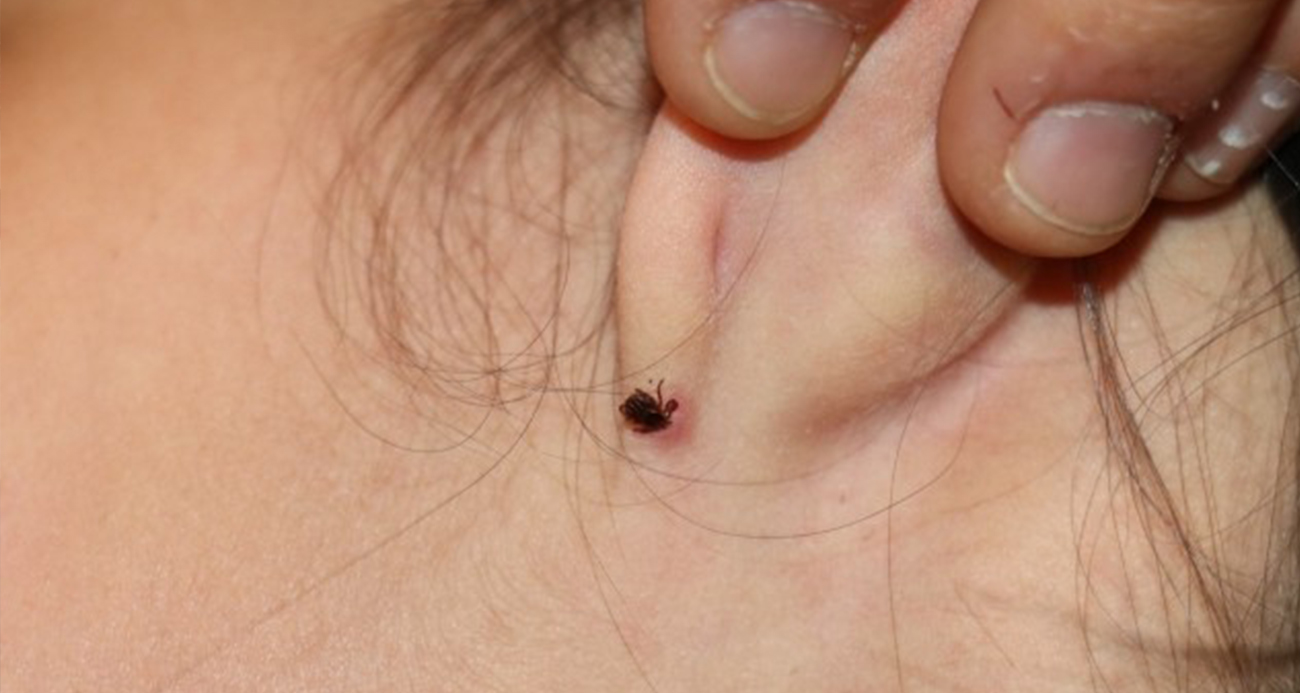 Havaların ısınmasıyla birlikte kenelerle temas riski arttı