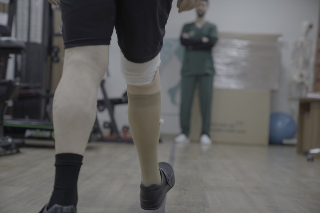 Üç uzvunu kaybetti, protezlerle hayata tutundu