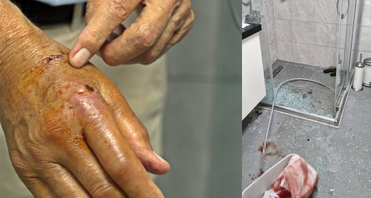 Patlayan duş kabininde yaralandı, 1 aydır direksiyon başına geçemiyor