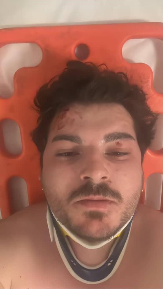 Darp edilen oyuncu dehşet anlarını anlattı: 