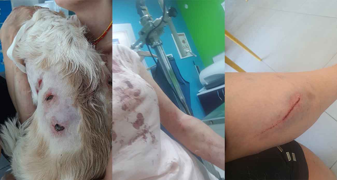 Bursa’da kangal dehşeti...O anlar kamerada