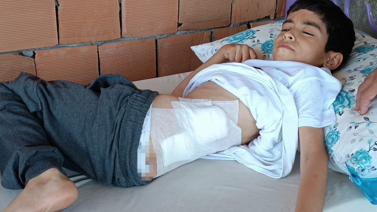 Bahçede oynayan 8 yaşındaki çocuk, yorgun mermi ile yaralandı