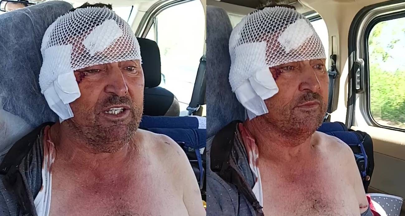Aslanın saldırısına uğrayan çiftçi o anları anlattı: "Biraz güçlü olmasaydım, şu anda bende belki de yoktum"