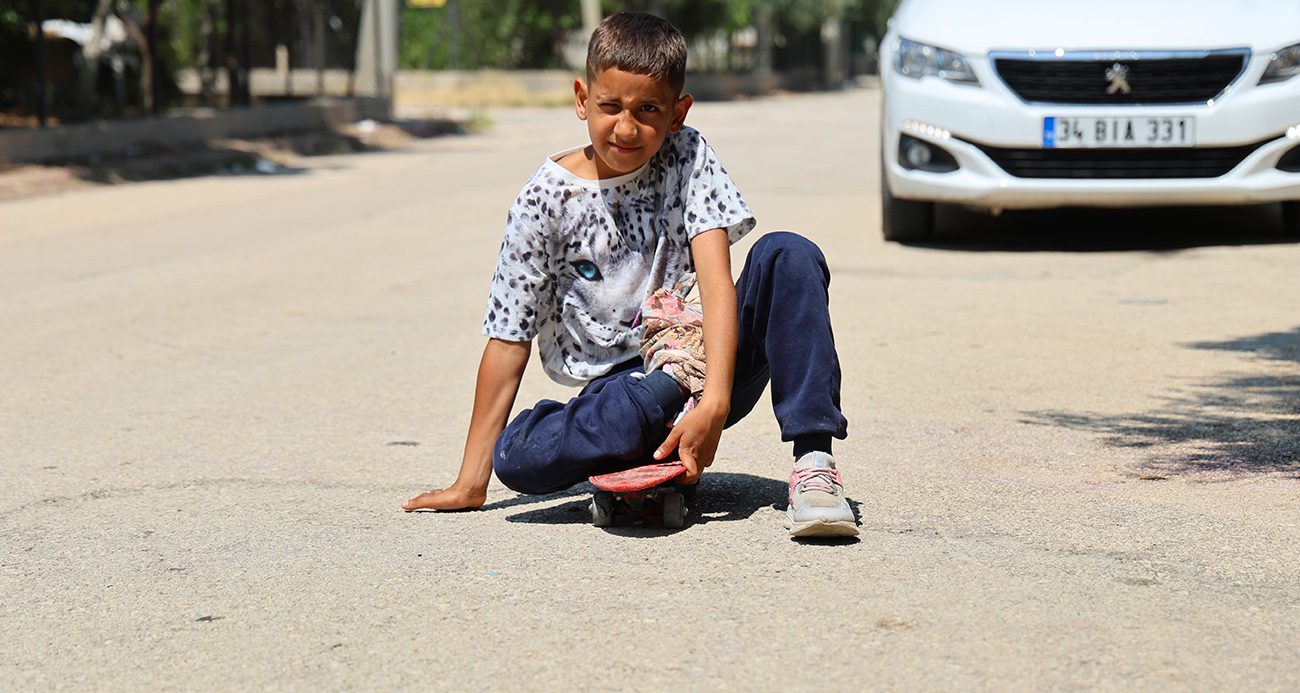Kaza sonrası ayağı yanlış kaynadı, hayatı kaykay üzerinde geçiyor