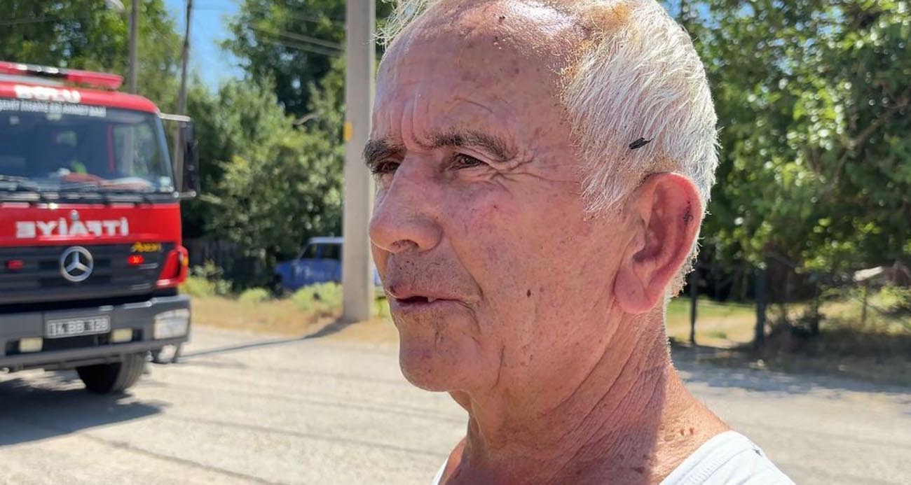 Çöpleri yakmak isterken kendini de yaktı