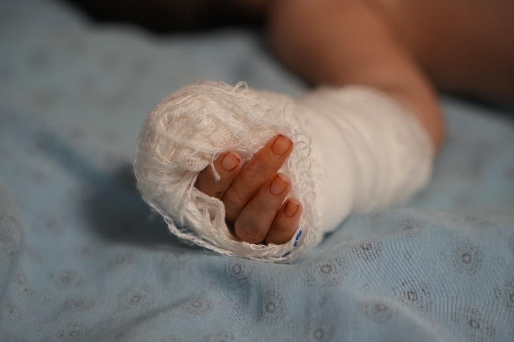 Serum kelebeğini çıkarmak isterken bebeğin parmağını kesti