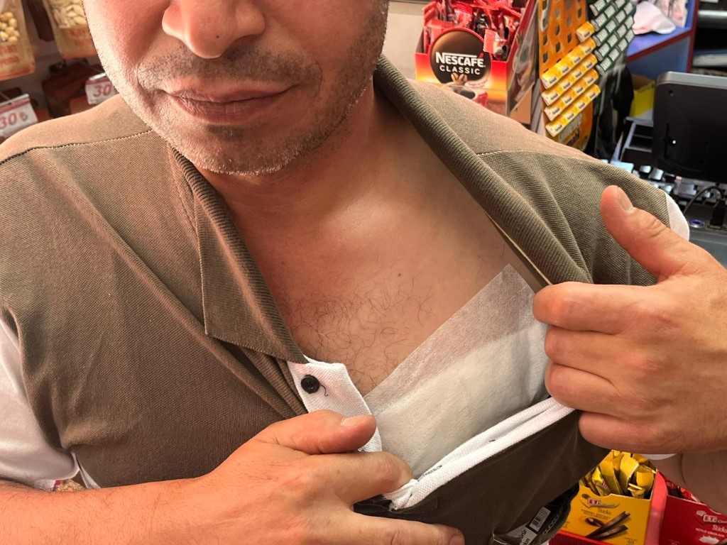 Eriyen dondurma nedeniyle palalı saldırıya uğrayan esnaf o anları anlattı