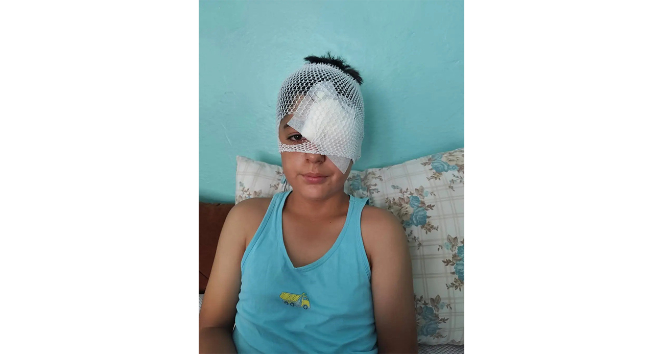 Şanlıurfa’da köpek saldırısından kaçan çocuğa otomobil çarptı