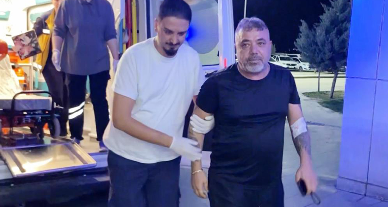 Bacağından vuruldu, sedyeyi reddedip yürüyerek acile girdi