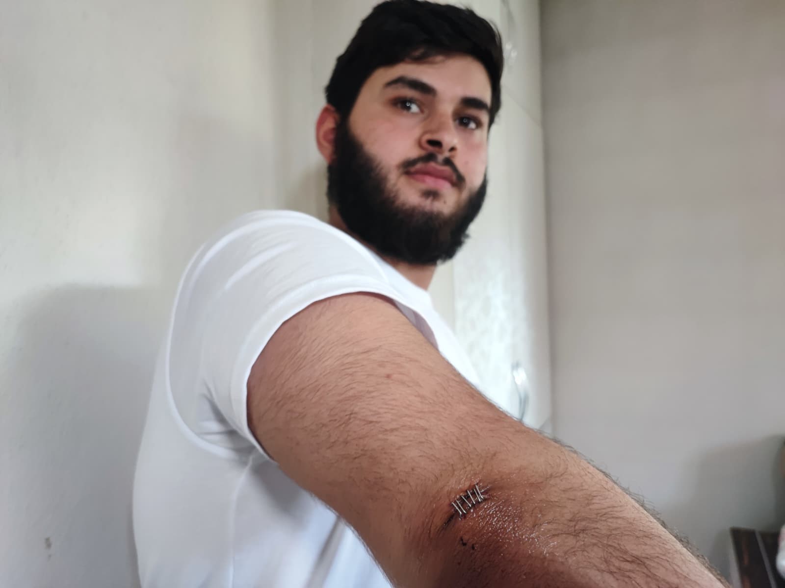 Conolar hem topu vermedi hem de aileye sopalı silahlı saldırıda bulundu