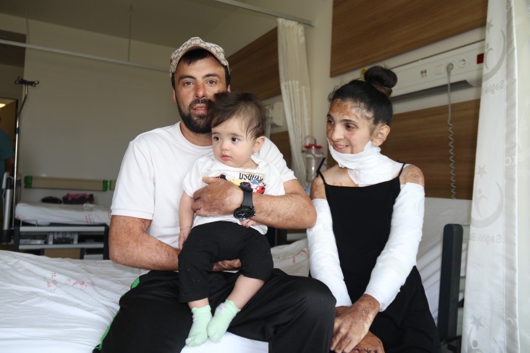 Azerbaycanlı çiftin doğal gaz patlamasında kapanan elleri, 3 yıl sonunda Eskişehir’deki tedaviyle kavuştu