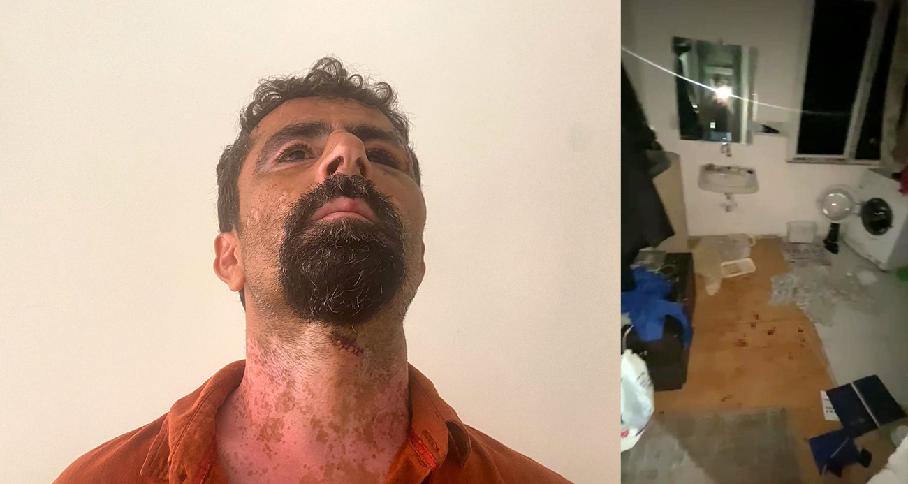 Antalya’da öfkeli damat kayınpederini hastanelik etti