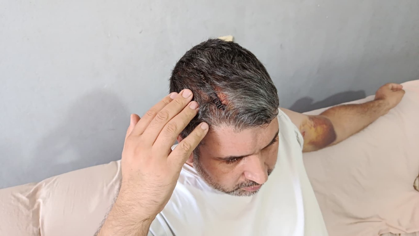 Miras kavgasında yeğenini darbeden dayı tutuklandı