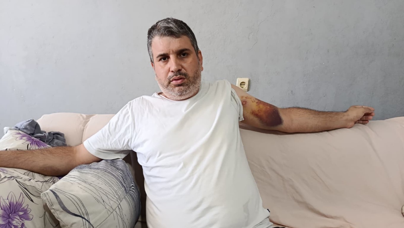 Miras kavgasında yeğenini darbeden dayı tutuklandı