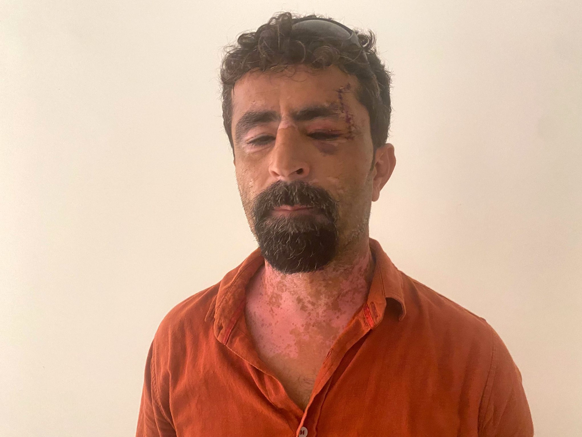 Antalya’da öfkeli damat kayınpederini hastanelik etti