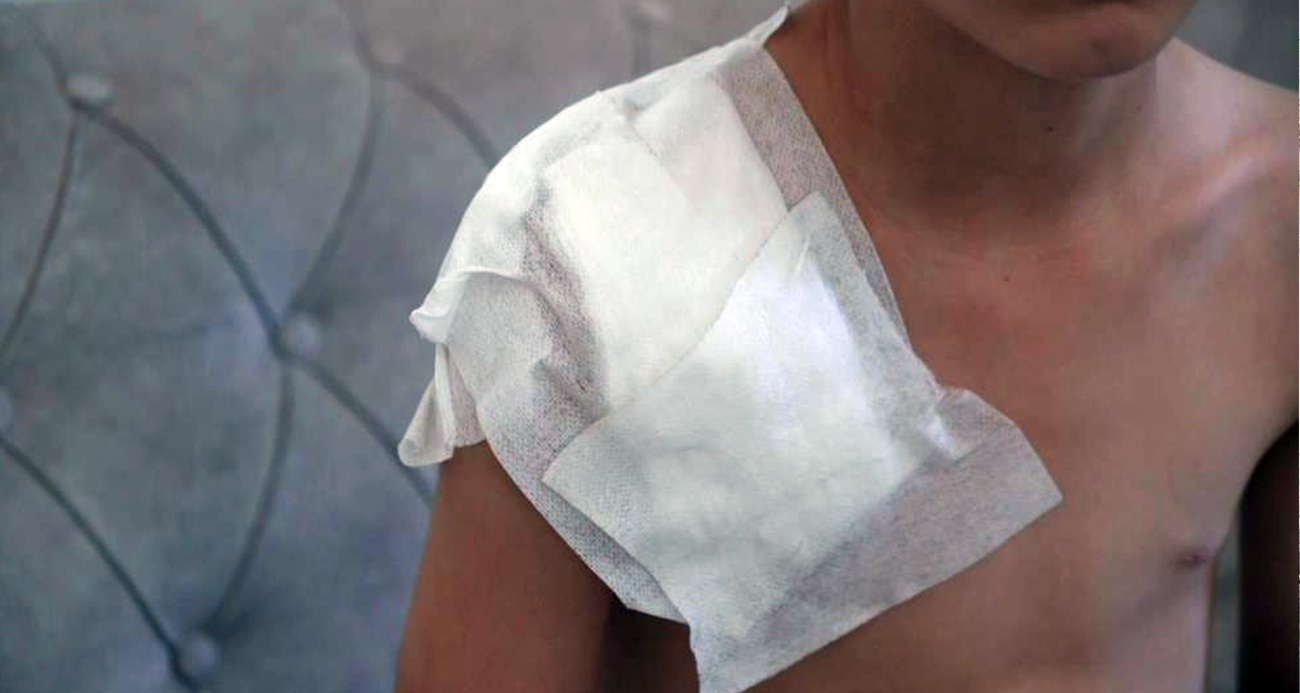 Vücudu köpek tarafından parçalanan Yunus’un kolu kullanılamaz hale geldi, aile adalet arıyor