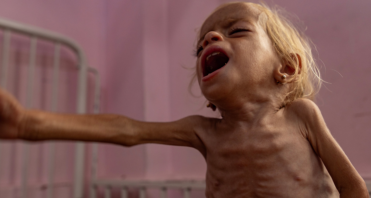 Gazze'de 3 Filistinli daha açlık nedeniyle hayatını kaybetti