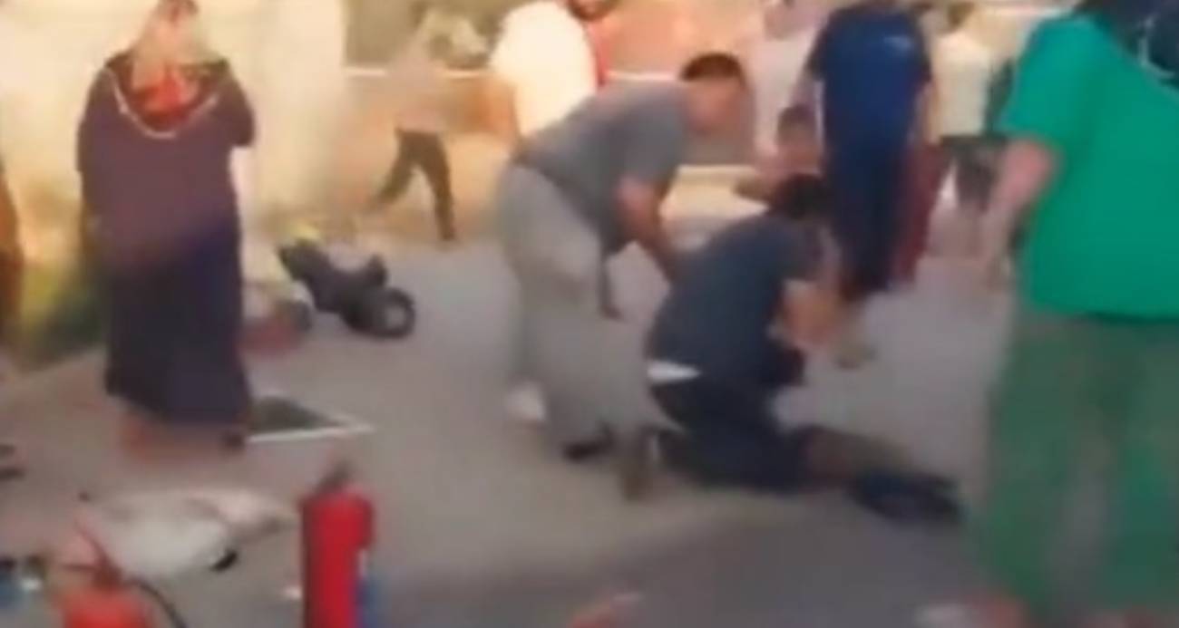 Yangında ağır yaralanan çocuk hayatını kaybetti