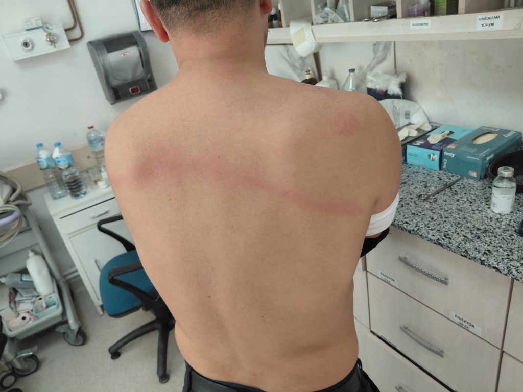 Zabıtayı sopayla döven dayakçı başkanın dosyası kabarık çıktı