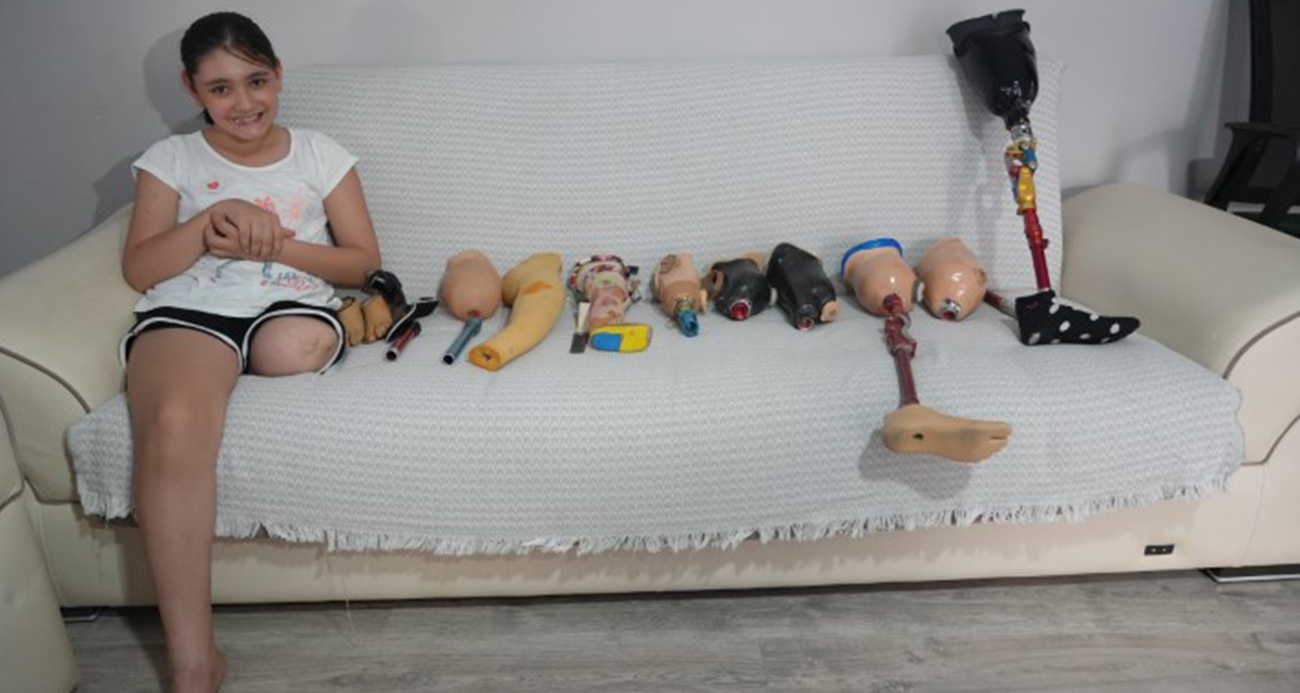 Okulların açılmasına günler kala 12 yaşındaki Özge’ye dar gelen protez bacak engeli