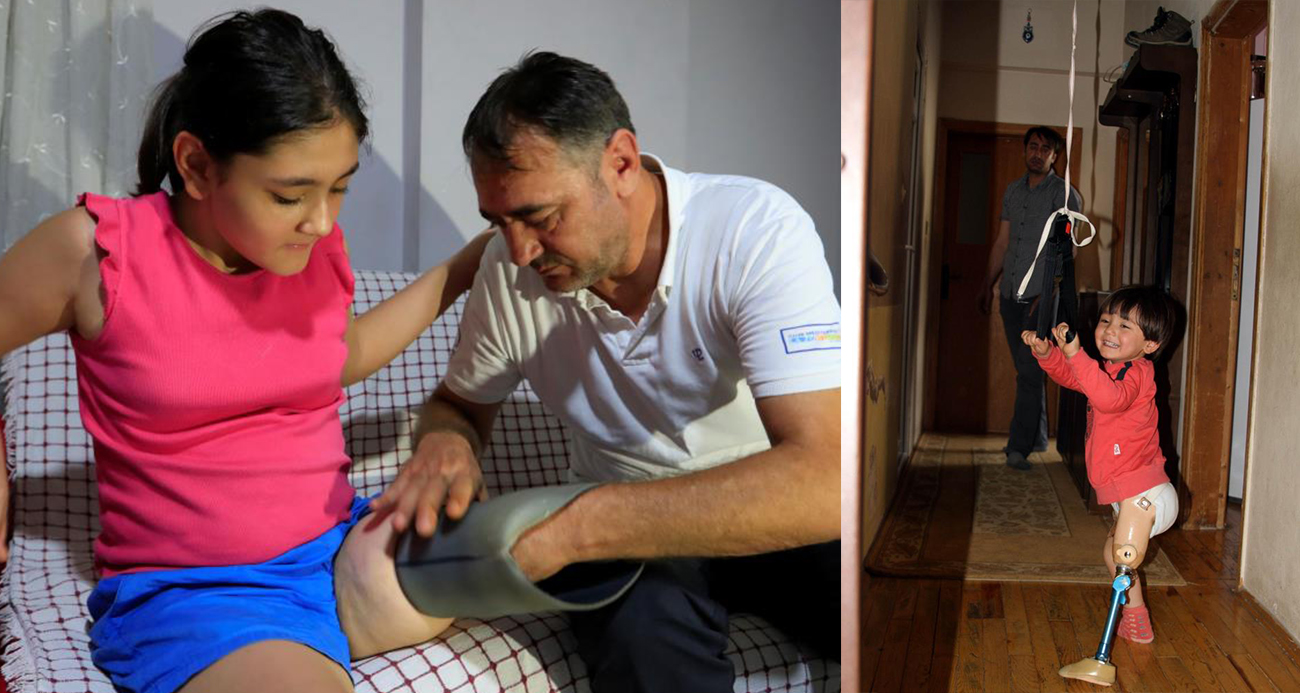 Protez bacağı dar gelen Özge için Türkiye ayağa kalktı