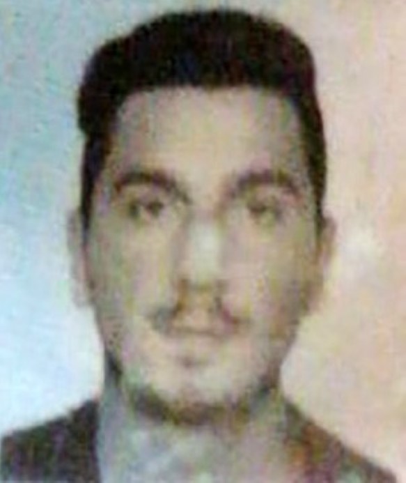 Tek yumrukla bayılttı, beyin kanaması geçirtti