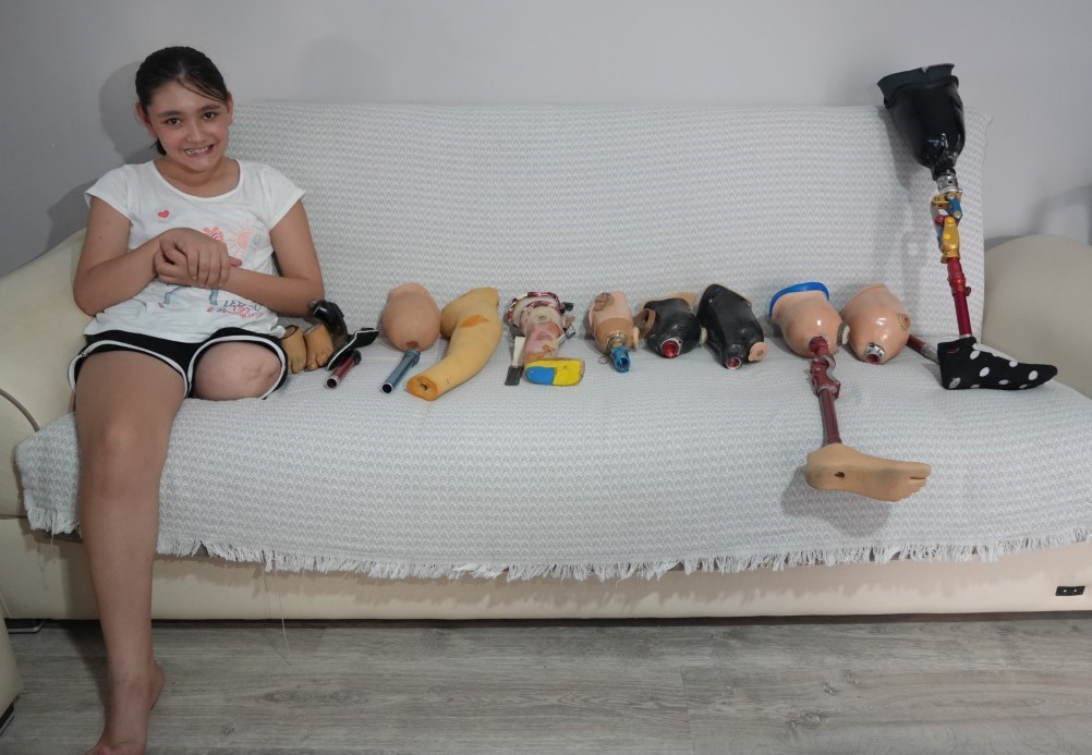 Özge protez bacağına kavuşuyor okula gitmek için gün sayıyor