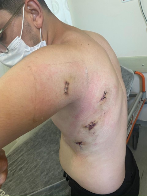 Kız kardeşini korumak isterken 5 yerinden bıçaklanmıştı: O anları anlattı: 